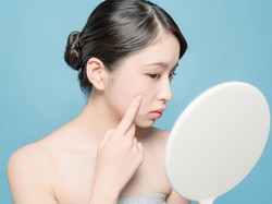 5 Alasan Jerawat Dapat Menyebabkan Bopeng pada Kulit