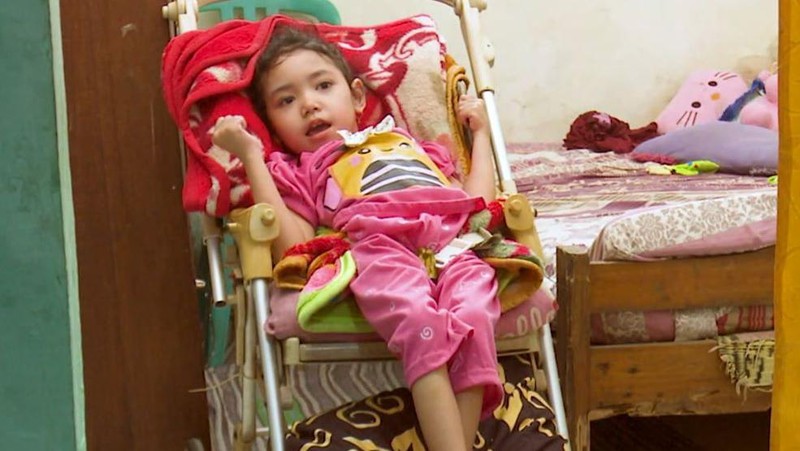 Nazila Bocah Yatim Piatu Alami Penyempitan Otak, Yuk Kita Bantu!