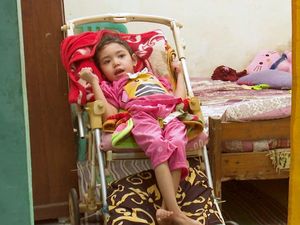 Nazila Bocah Yatim Piatu Alami Penyempitan Otak, Yuk Kita Bantu!