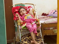 Nazila Bocah Yatim Piatu Alami Penyempitan Otak, Yuk Kita Bantu!