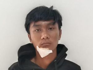Tampang Pemotor yang Tabrak Polantas hingga Tangan Patah Saat Operasi Patuh Tampang Pemotor yang Tabrak Polantas hingga Tangan Patah Saat Operasi Patuh