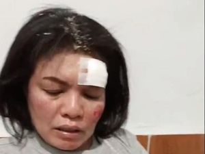 Polisi Proses Identifikasi Pelaku Begal Pegawai Kodam I/BB Polisi Proses Identifikasi Pelaku Begal Pegawai Kodam I/BB