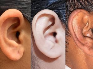 Studi Terbaru: Telinga Bisa Jadi Alat Pengidentifikasi seperti Sidik Jari?