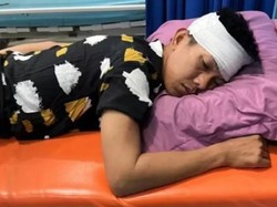 Pecah Kepala Polisi Diserang Warga yang Terganggu dengan Patroli