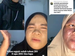 Kulit Tya Gosong Usai Pakai Krim Pemutih Wajah Bermerkuri