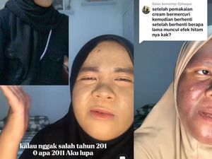 Viral Wajah Wanita Kaltim Gosong gegara Krim Merkuri, Awalnya Glowing Banget Viral Wajah Wanita Kaltim Gosong gegara Krim Merkuri, Awalnya Glowing Banget