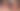 Viral kisah wanita mengalami warna kulit wajah menggelap gegara penggunaan krim wajah bermerkuri. Foto: Tangkapan layar viral @nurnnyas atas izin yang bersangkutan