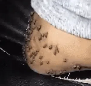 Awas! Nyamuk dari Waduk Saguling Bisa Sebabkan Penyakit Kaki Gajah