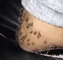 Awas! Nyamuk dari Waduk Saguling Bisa Sebabkan Penyakit Kaki Gajah