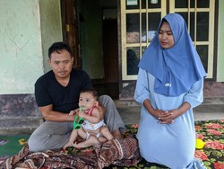 Ibu Bayi Berkaki 6 di Lombok Berharap Karunia Segera Dioperasi