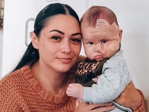 Ibu Ini Disebut Monster karena Laser Wajah Bayinya untuk Hilangkan Tanda Lahir Ibu Ini Disebut Monster karena Laser Wajah Bayinya untuk Hilangkan Tanda Lahir