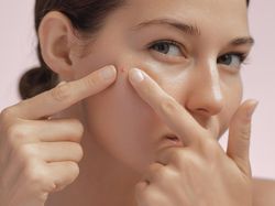 Terlalu Sering Minum Kopi Bisa Sebabkan Jerawat, Mitos atau Fakta?