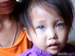 Pesona Bola Mata Tiga Warna Amelia Anggraeni dari Bandung