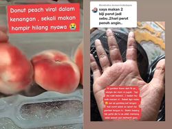 Niat Cicip Donat Unik, Wanita Ini Malah Masuk Rumah Sakit