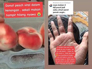 Niat Cicip Donat Unik, Wanita Ini Malah Masuk Rumah Sakit Niat Cicip Donat Unik, Wanita Ini Malah Masuk Rumah Sakit