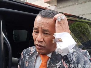Hotman Paris Juga Sama Kok, Makin Stres Jelang Pernikahan Anak Hotman Paris Juga Sama Kok, Makin Stres Jelang Pernikahan Anak