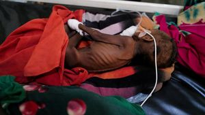 Potret Pilu Anak-anak Kekurangan Gizi Sudan Bertahan Hidup di Pengungsian