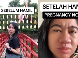 Viral di TikTok, 3 Fakta Pregnancy Nose saat Hidung Ikut Hamil Jelang Lahiran