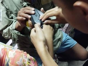 Pemadam Kebakaran Turun Tangan Bantu Bocah yang Jarinya Kejepit Spion Motor