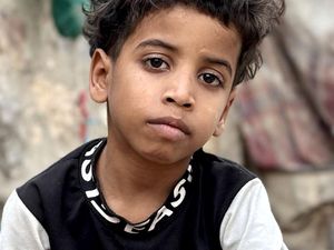 Penderitaan Anak-anak Yaman Jadi Korban Perang Bertahun-tahun Penderitaan Anak-anak Yaman Jadi Korban Perang Bertahun-tahun