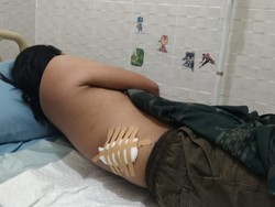 Pria di Lamongan Tanpa Sebab Tiba-tiba Bacok Tetangganya