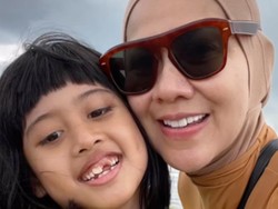 Mata Putri Venna Melinda Dilempar Batu di Sekolah, Begini Kronologinya