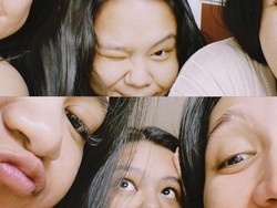 Hari Sahabat Sedunia 2023, Ini Manfaat Punya Bestie Bagi Kesehatan Mental