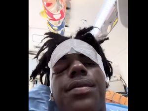 Youtuber IShowSpeed Kesakitan Parah gegara Cluster Headache, Kondisi Apa Itu?