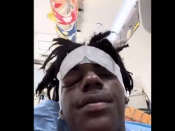 Youtuber IShowSpeed Kesakitan Parah gegara Cluster Headache, Kondisi Apa Itu?