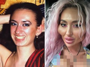 Usai Pipi Besar, Wanita Ini Ingin Punya Payudara Tak Wajar