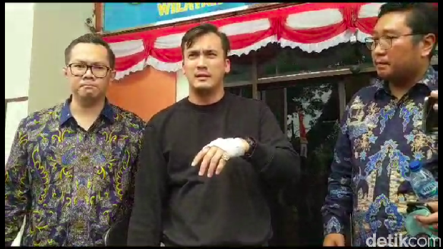 Rawat Lady Usai Kecelakaan, Rendy Kjaernett: Dia yang Paling Penting di Dunia