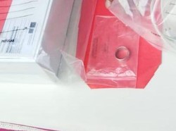 Cincin di Kerongkongan Mahasiswa UI Bukti Perlawanan Terakhirnya saat Dibunuh