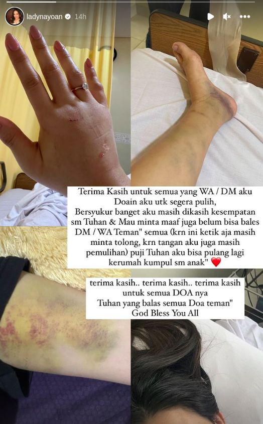 Instagram Stories Lady Nayoan