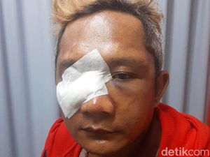 Gegara Ngopi dengan Perempuan, Warga Jombang Babak Belur Dikeroyok 2 Pria