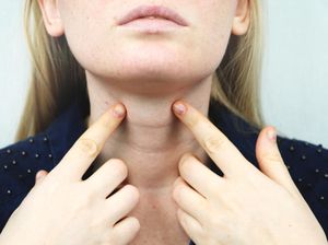 7 Penyebab Jerawat di Leher, Fluktuasi Hormon hingga Jorok