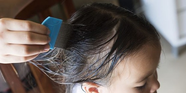 Sisir Kutu Cara Hilangkan Kutu Rambut/Foto:Pinterest/sehatq.com Sisir Kutu Cara Hilangkan Kutu Rambut
