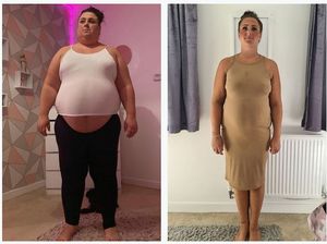 Tak Lagi Konsumsi Buah, Wanita Ini Turun BB hingga 89 Kg