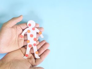 5 Fakta Remaja Parepare Alami Kulit Melepuh Usai Konsumsi Obat dari Puskesmas 5 Fakta Remaja Parepare Alami Kulit Melepuh Usai Konsumsi Obat dari Puskesmas