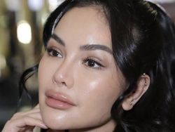 Potret Wajah Baru Nikita Mirzani Usai Operasi Plastik yang Bikin Pangling