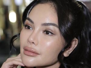Potret Wajah Baru Nikita Mirzani Usai Operasi Plastik yang Bikin Pangling