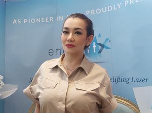 Reza Artamevia Jalani Perawatan Pengencangan Kulit, Sudah Izin Aaliyah-Zahwa Massaid