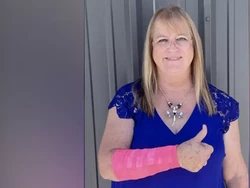 Lagi Anteng Potong Rumput, Wanita Ini Dikeroyok Elang dan Ular