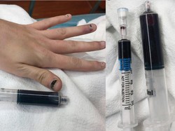 Heboh Wanita Berdarah Biru Usai Konsumsi Obat Sakit Gigi