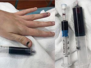 Heboh Wanita Berdarah Biru Usai Konsumsi Obat Sakit Gigi Heboh Wanita Berdarah Biru Usai Konsumsi Obat Sakit Gigi