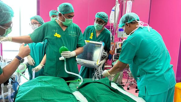 Bayi Kembar Siam Asal Pasuruan Berhasil Dipisahkan di RSSA Malang