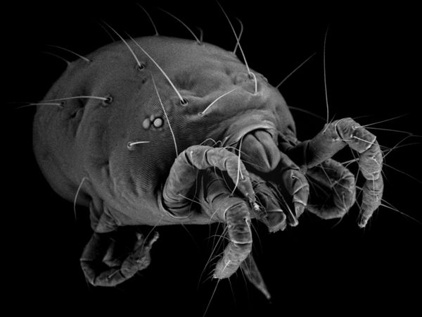 Foto Menyeramkan Hewan Saat Dilihat Pakai Mikroskop