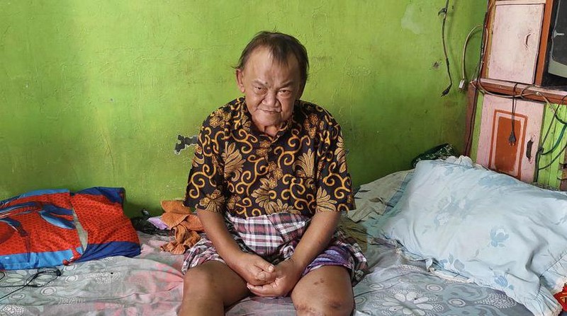 Mari Bantu Kakek Tojadi Penjual Gorengan Agar Dapat Kaki Palsu