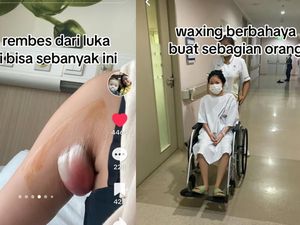 Ketiak Wanita Harus Dioperasi Usai Waxing, Ternyata Ini Penyebabnya Ketiak Wanita Harus Dioperasi Usai Waxing, Ternyata Ini Penyebabnya