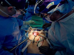 Jadi yang Pertama di Dunia, Ini Alasan Pasien Pria AS Jalani Cangkok Ginjal Babi