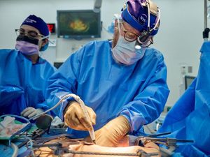 Ginjal Babi yang Dicangkok ke Tubuh Manusia Berhasil Bekerja Selama 2 Bulan